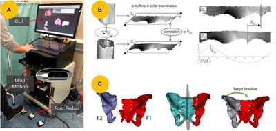 Technologies evolution in robot-assisted fracture reduction systems: a comprehensive review